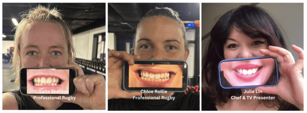 BSPD and Dental Trauma UK announce new collaboration to support clinicians