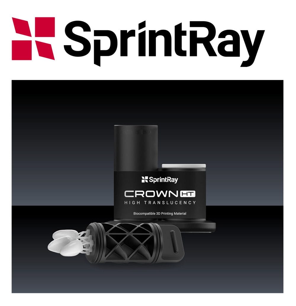 Next-level chairside restorations with the SprintRay Midas and Crown HT