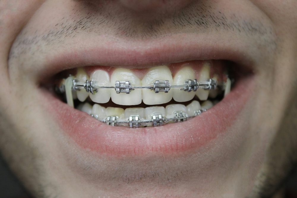 Root resorption and orthodontics: a practical guide for the referring GDP