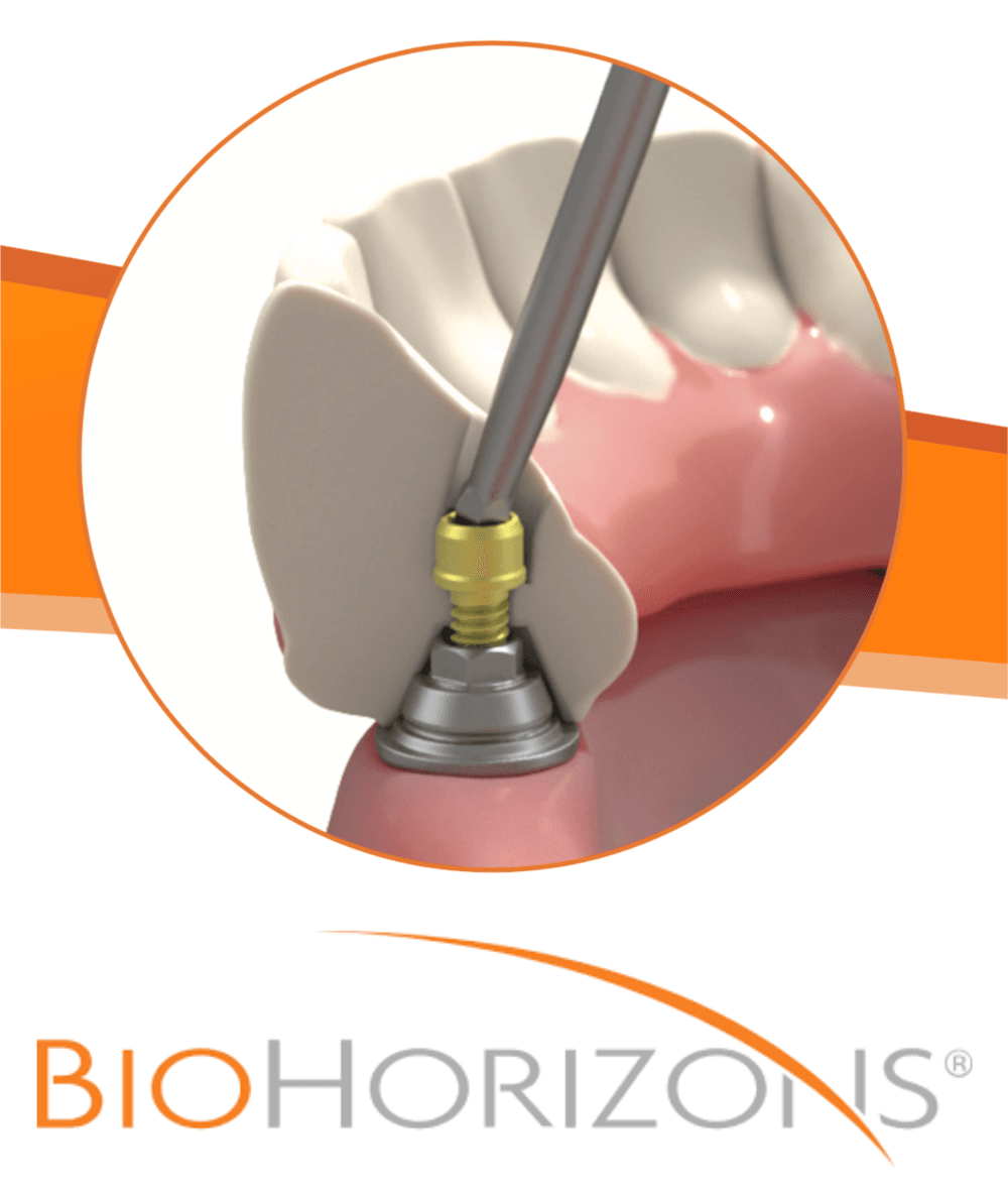 The BioHorizons advantage