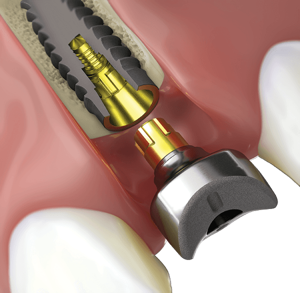 Want to reduce your treatment times?