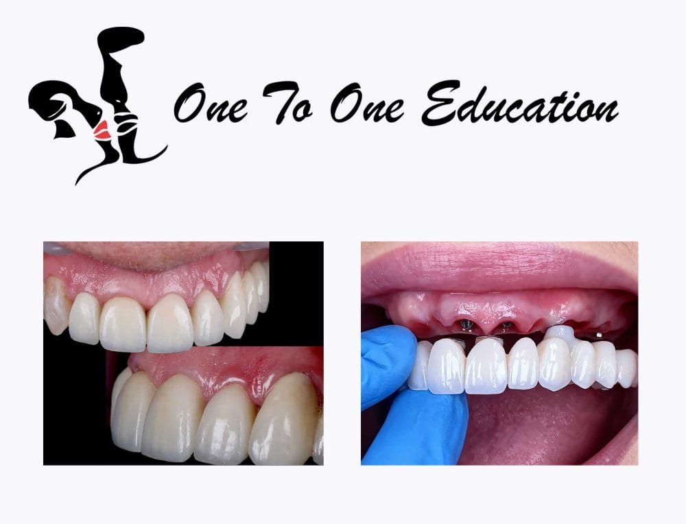 Rehabilitation, not just restoration
