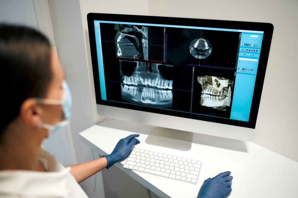 When do you actually need a CBCT?
